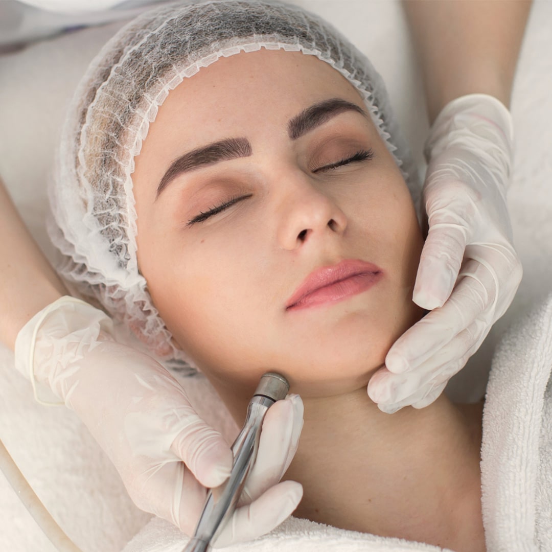 Microdermabrasion